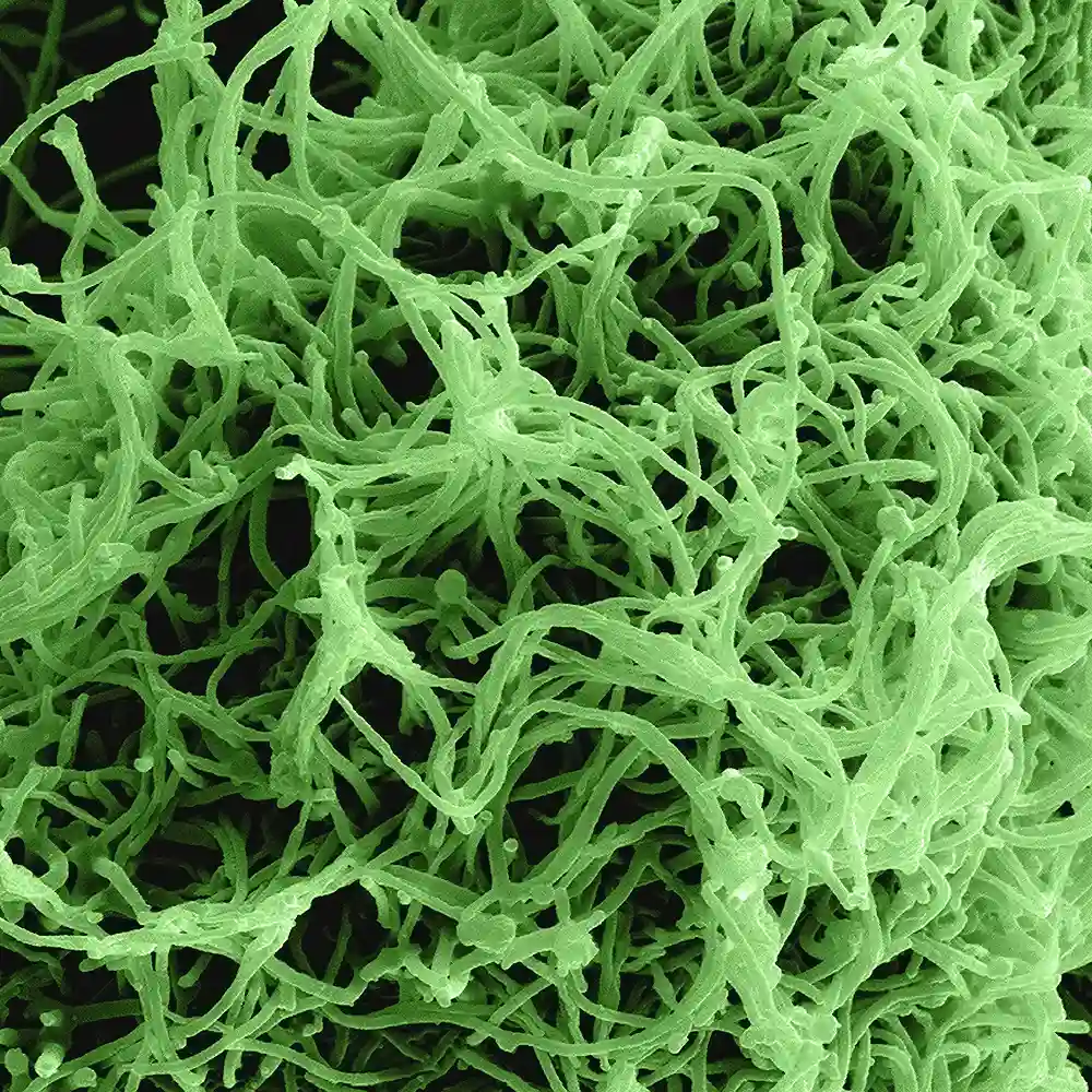 NGS for Ebola Virus