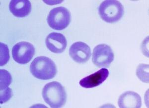 microhaplotypes from the Plasmodium falciparum heterozygome