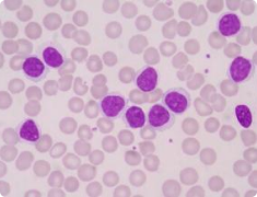 Molecular assessment of pretransplant chemotherapy