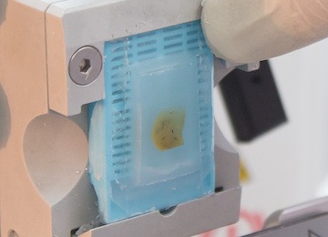Icon_CleanPlex_FFPE solid tumor profiling of FFPE samples