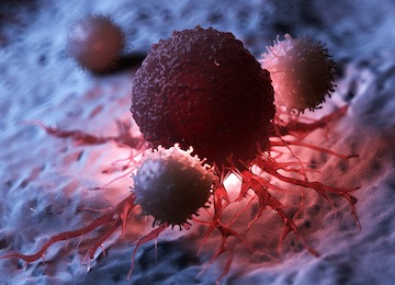TMB tumor mutational burden analysis via NGS targeted amplicon sequencing TMB tumor mutational burden analysis via NGS targeted amplicon sequencing