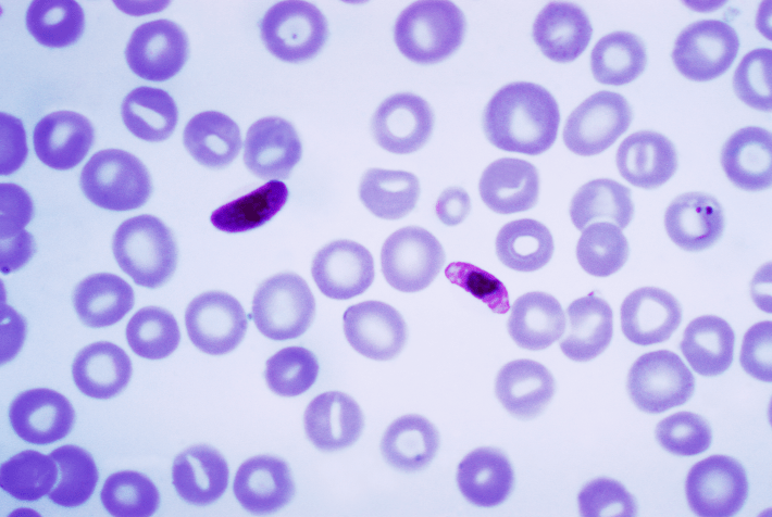 Plasmodium_falciparum_01 Rendering of a T Cell