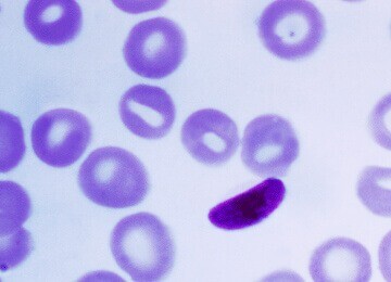 Publication_Plasmodium_falciparum_360x260_compressed Rendering of a T Cell
